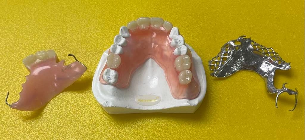 Partial Dentures